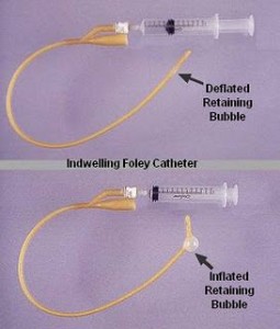 foley catheter indications Archives - Webdicine