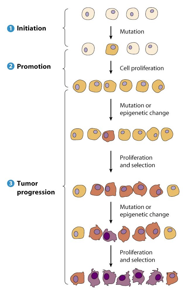 3 stages of cancer developement